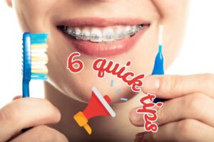 6 Oral hygene tips during Braces and aligner