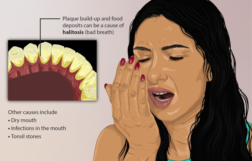 casues of bad breath